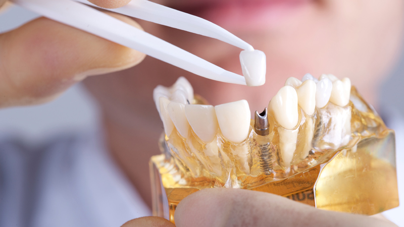 Dentist Ruimsig
