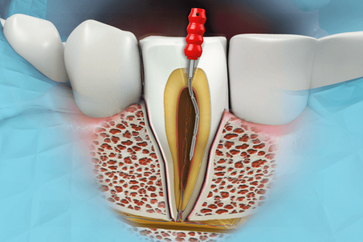 Dentist Ruimsig